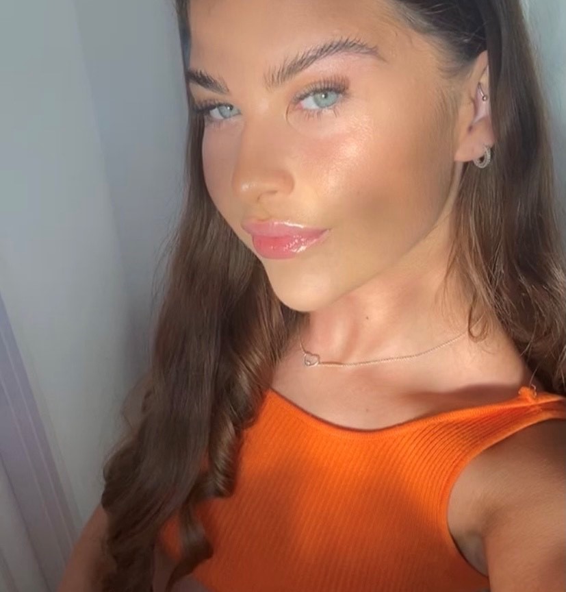 Skye Fisher - Case Manager